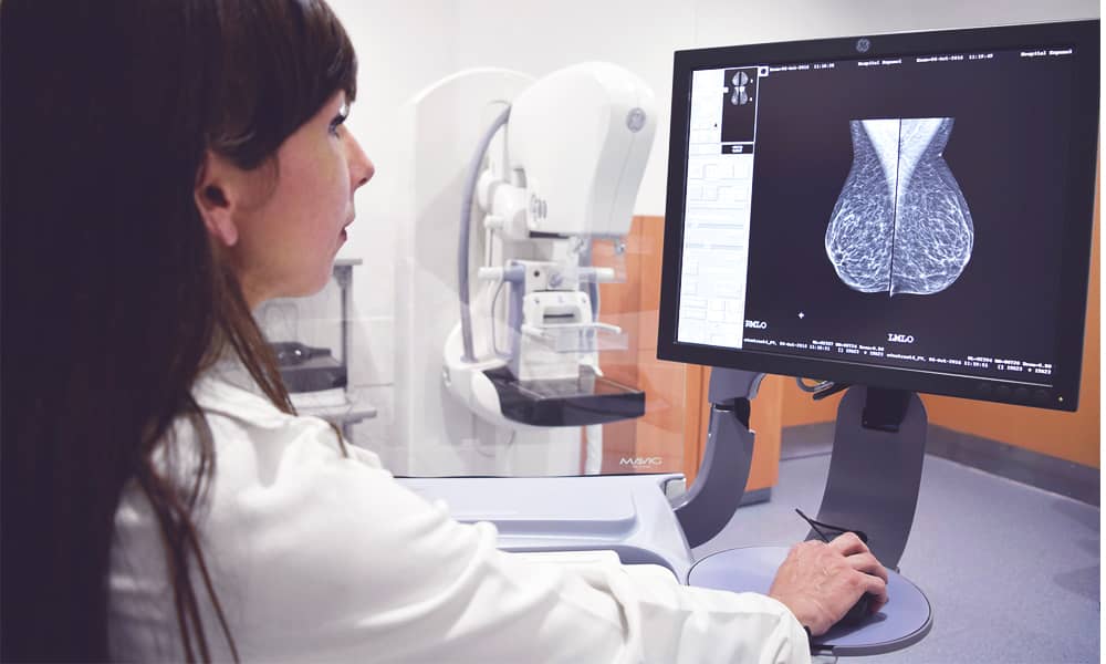 Mastografía